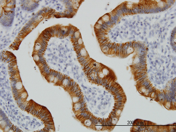 KRT17 Antibody in Immunohistochemistry (Paraffin) (IHC (P))