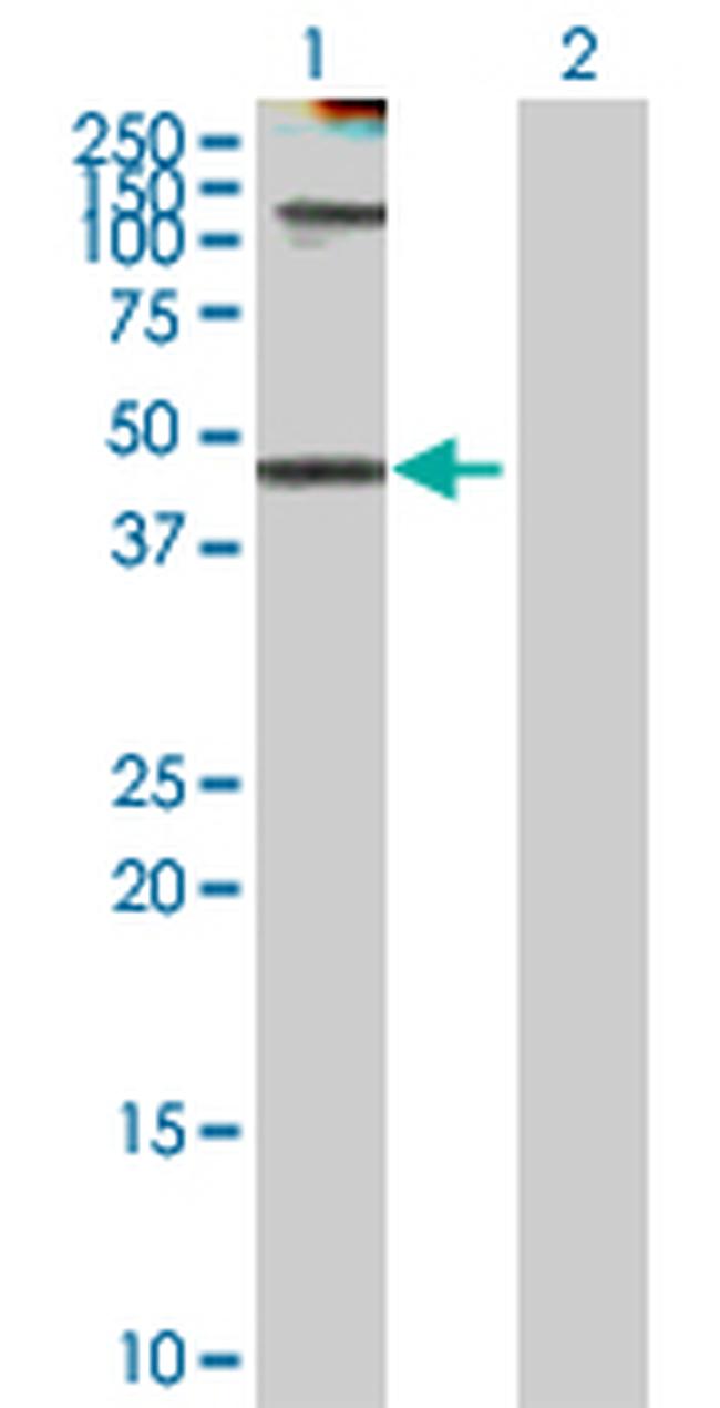 KRT18 Antibody in Western Blot (WB)