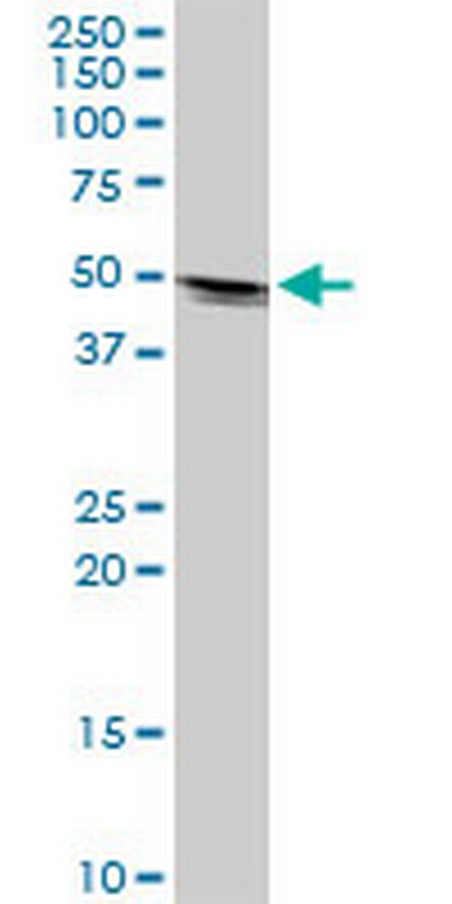 KRTHA2 Antibody in Western Blot (WB)