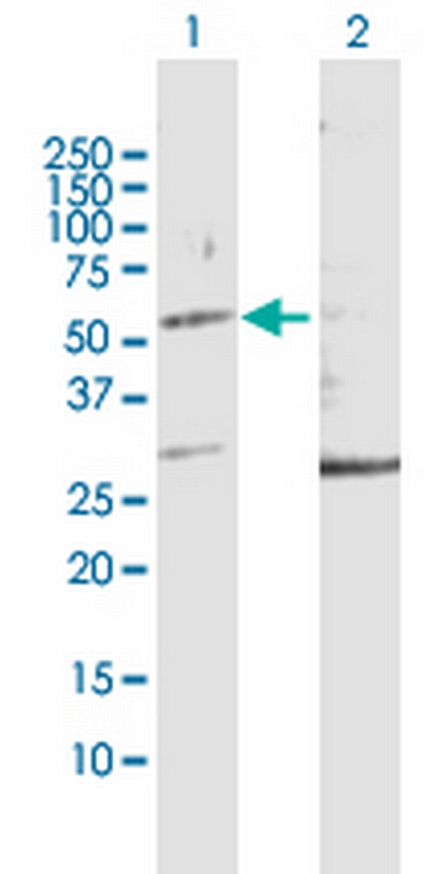 KRT32 Antibody in Western Blot (WB)