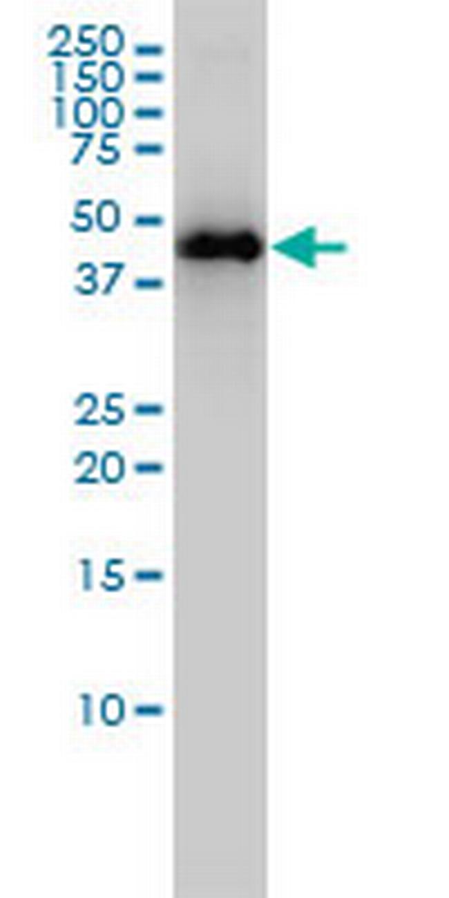 KRTHA3B Antibody in Western Blot (WB)