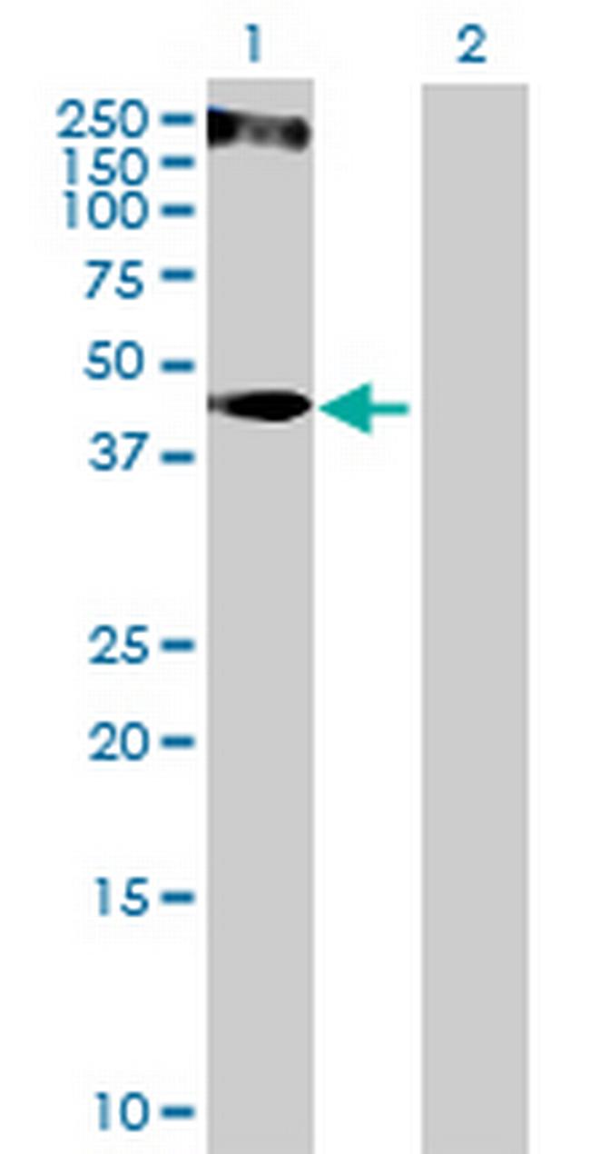 KRT34 Antibody in Western Blot (WB)