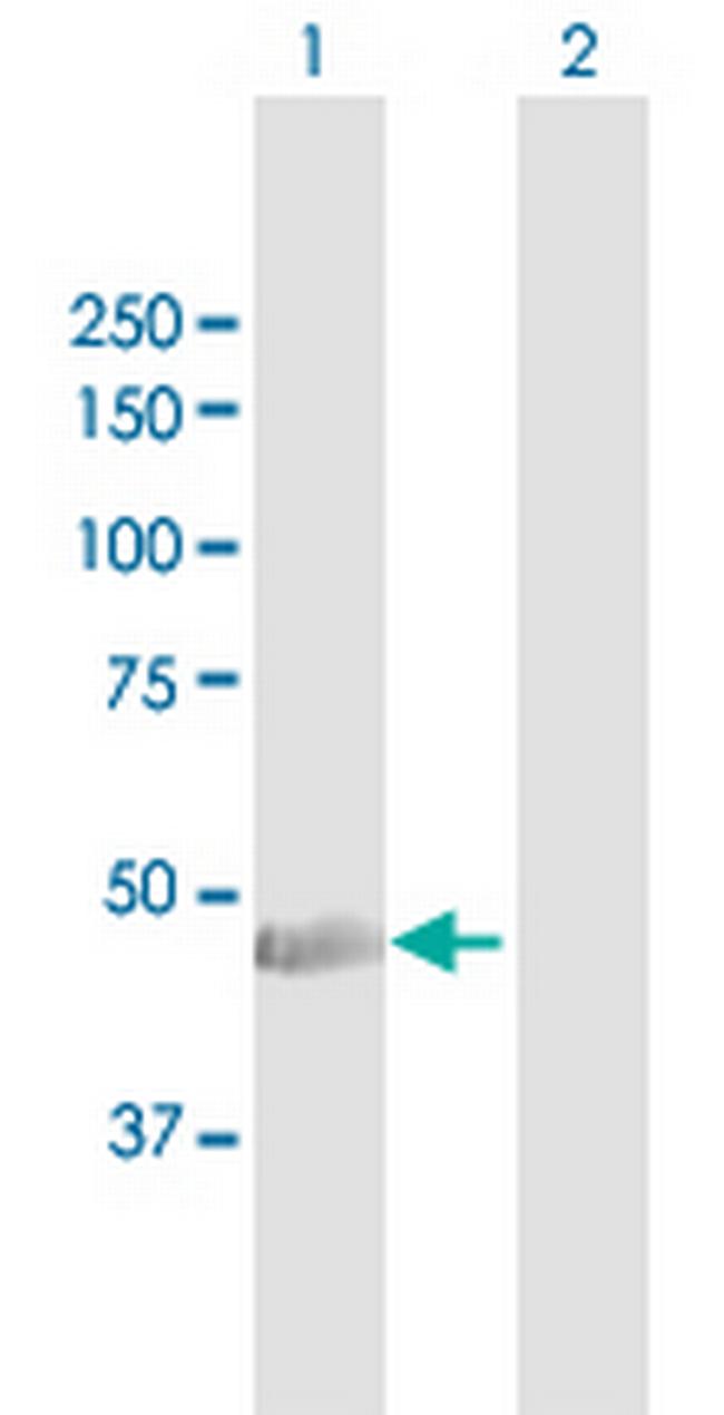 KRT34 Antibody in Western Blot (WB)