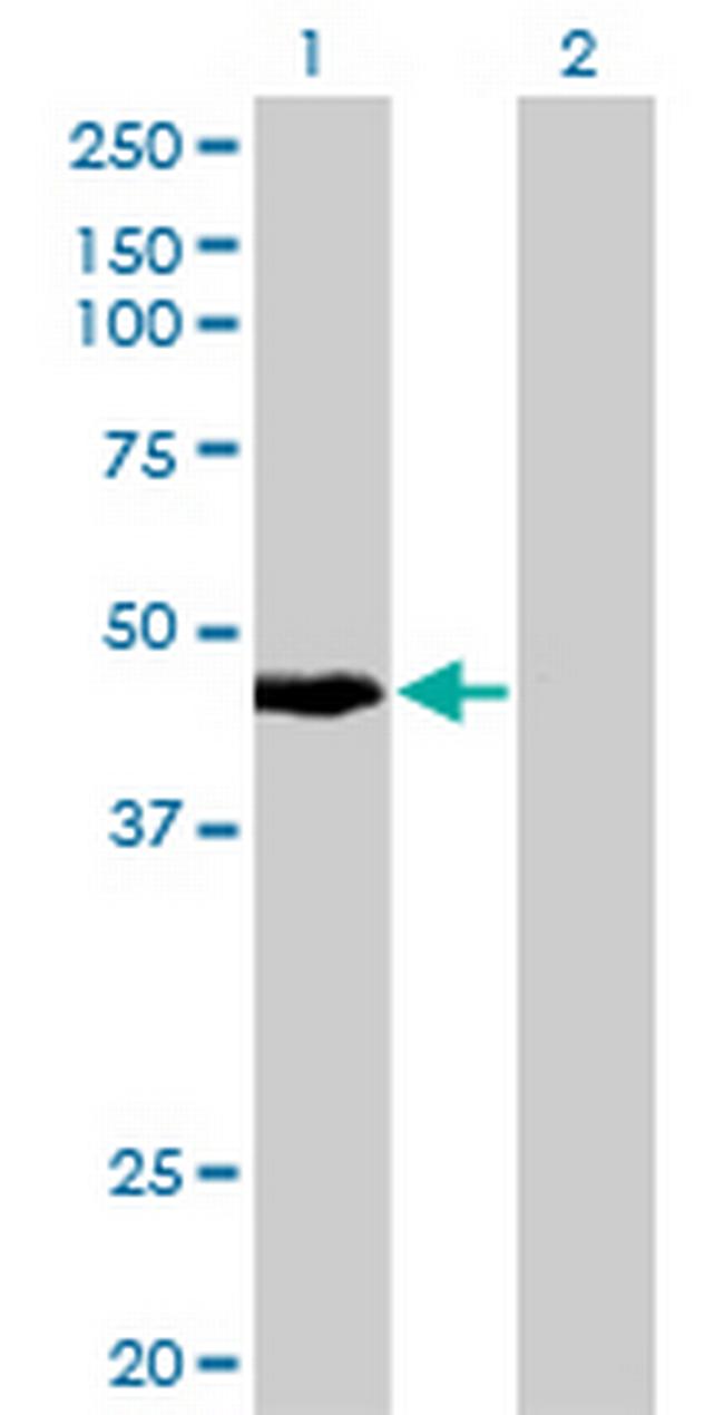 KRTHA4 Antibody in Western Blot (WB)