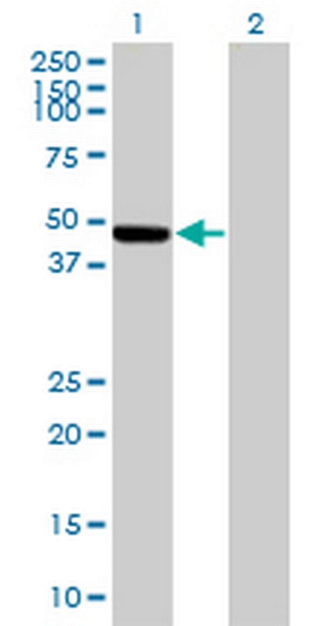 KRTHA5 Antibody in Western Blot (WB)