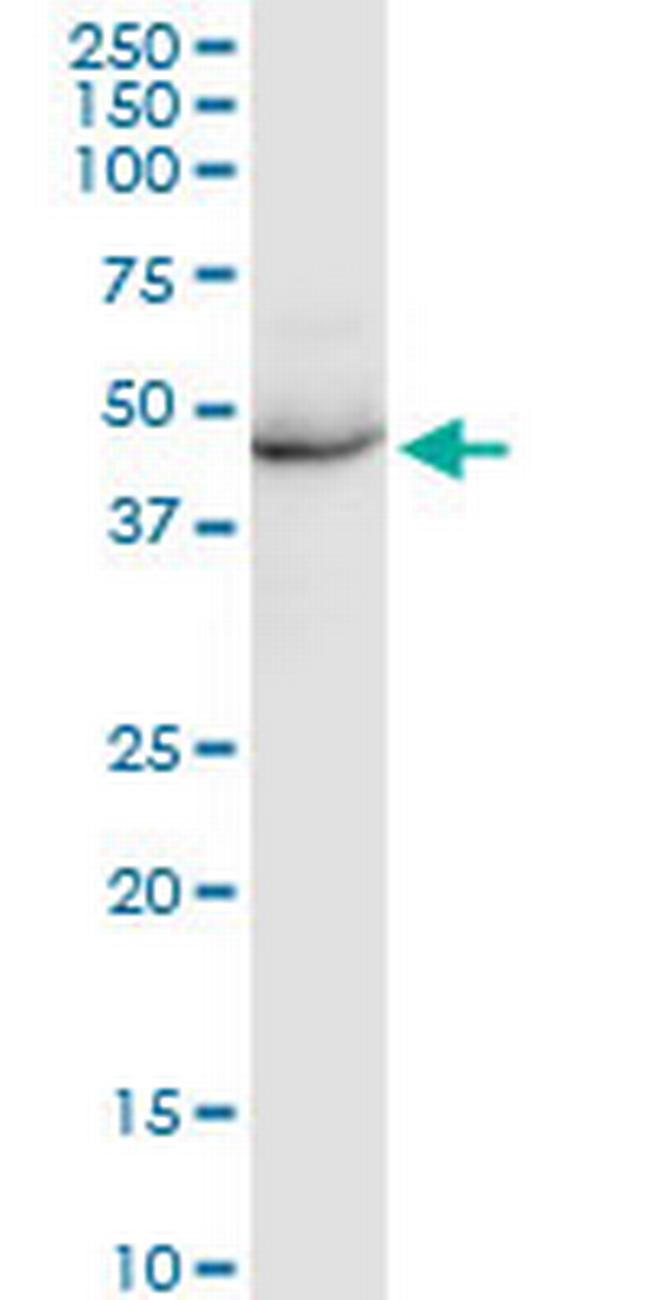 KRT35 Antibody in Western Blot (WB)