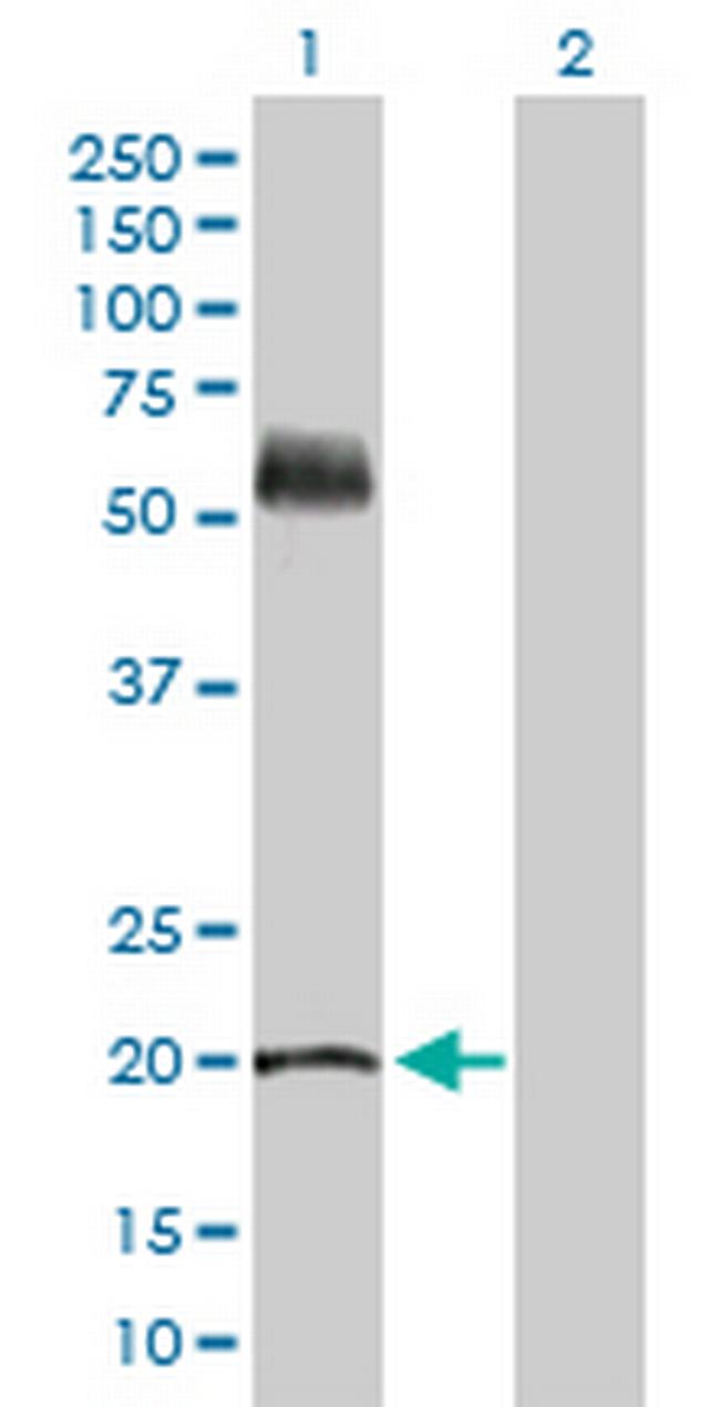 KRT81 Antibody in Western Blot (WB)
