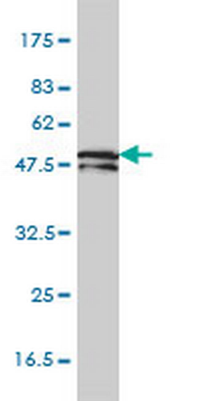 KRTHB1 Antibody in Western Blot (WB)