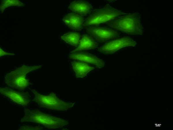KRT81 Antibody in Immunocytochemistry (ICC/IF)