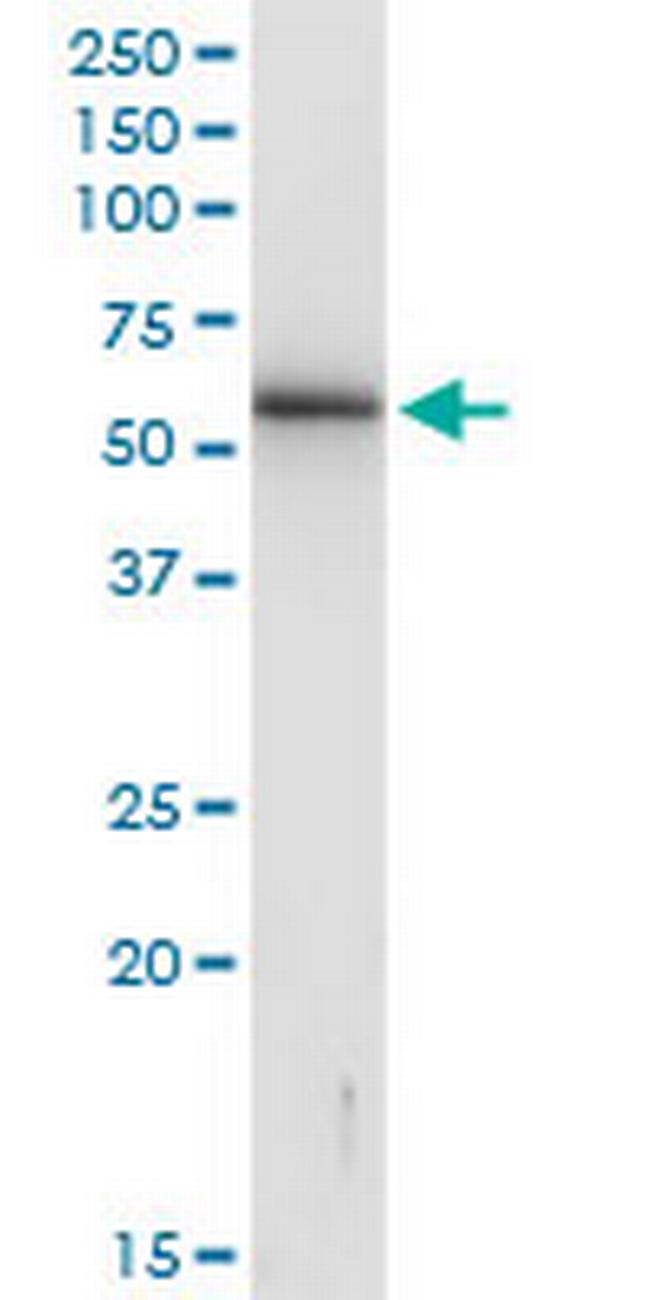 KRTHB3 Antibody in Western Blot (WB)