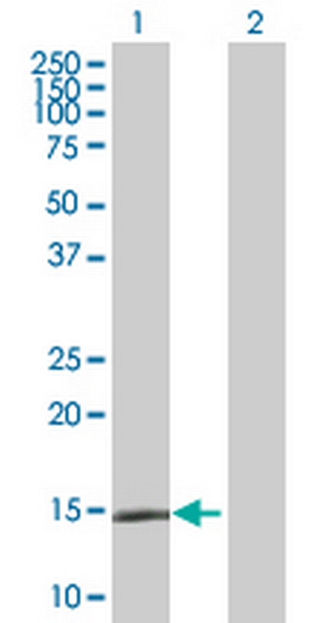 LAMA4 Antibody in Western Blot (WB)