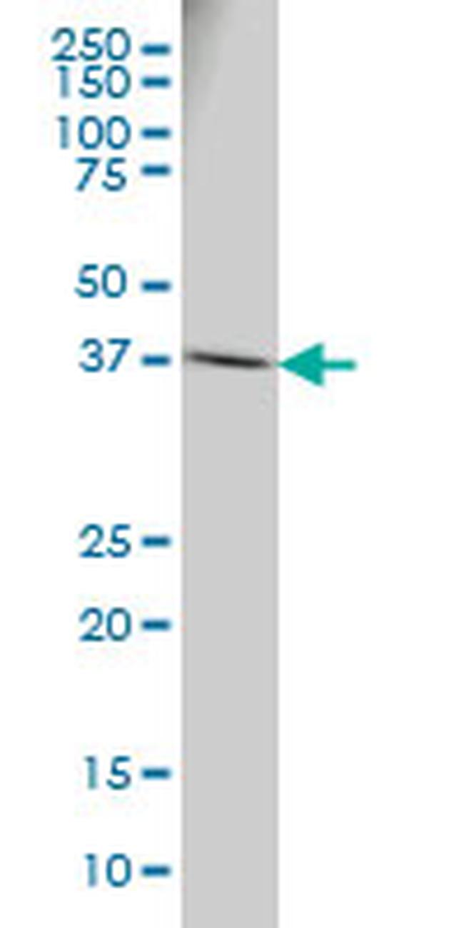 RPSA Antibody in Western Blot (WB)