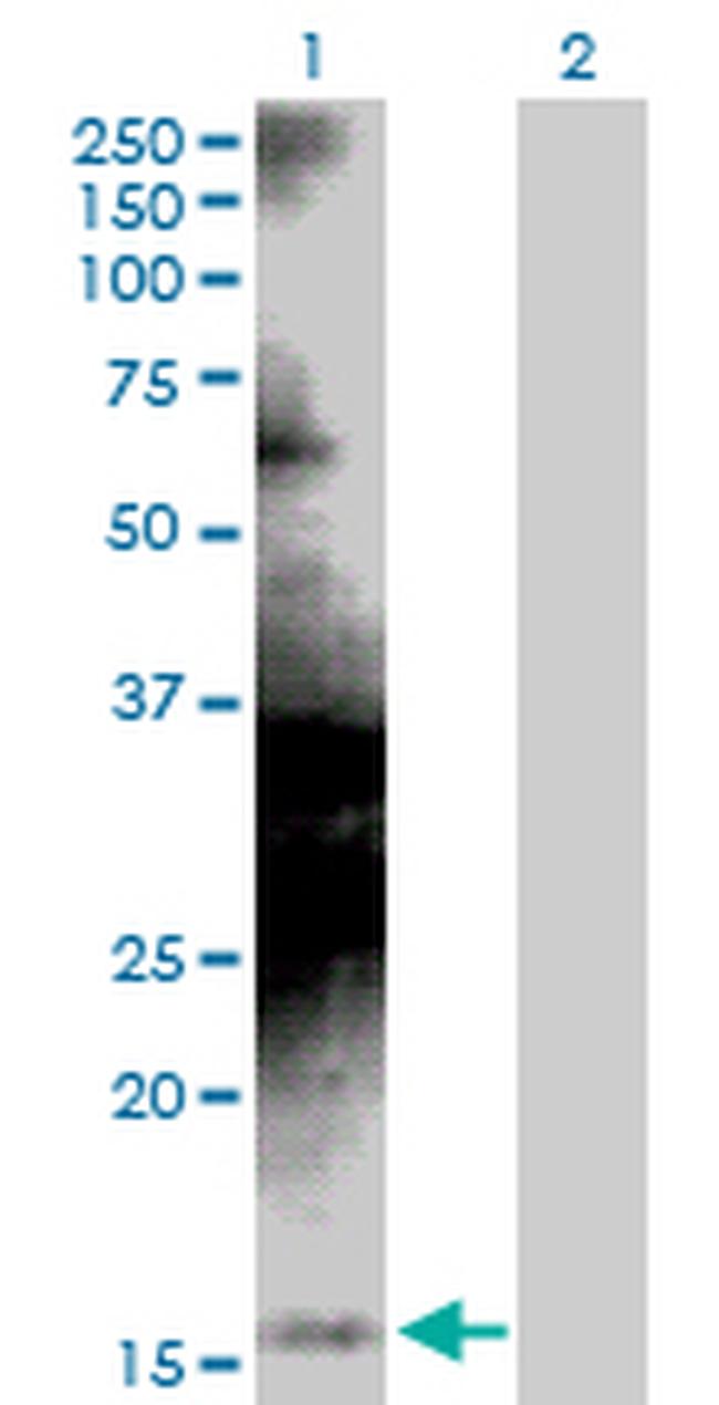 STMN1 Antibody in Western Blot (WB)