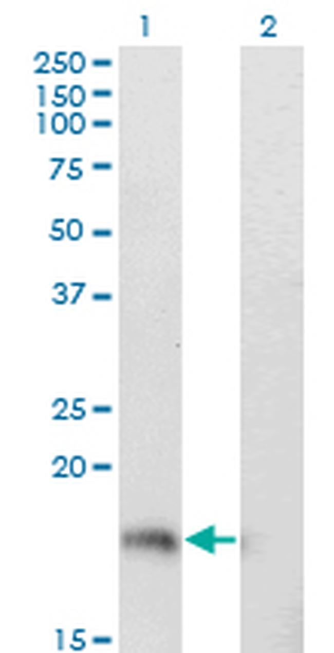STMN1 Antibody in Western Blot (WB)