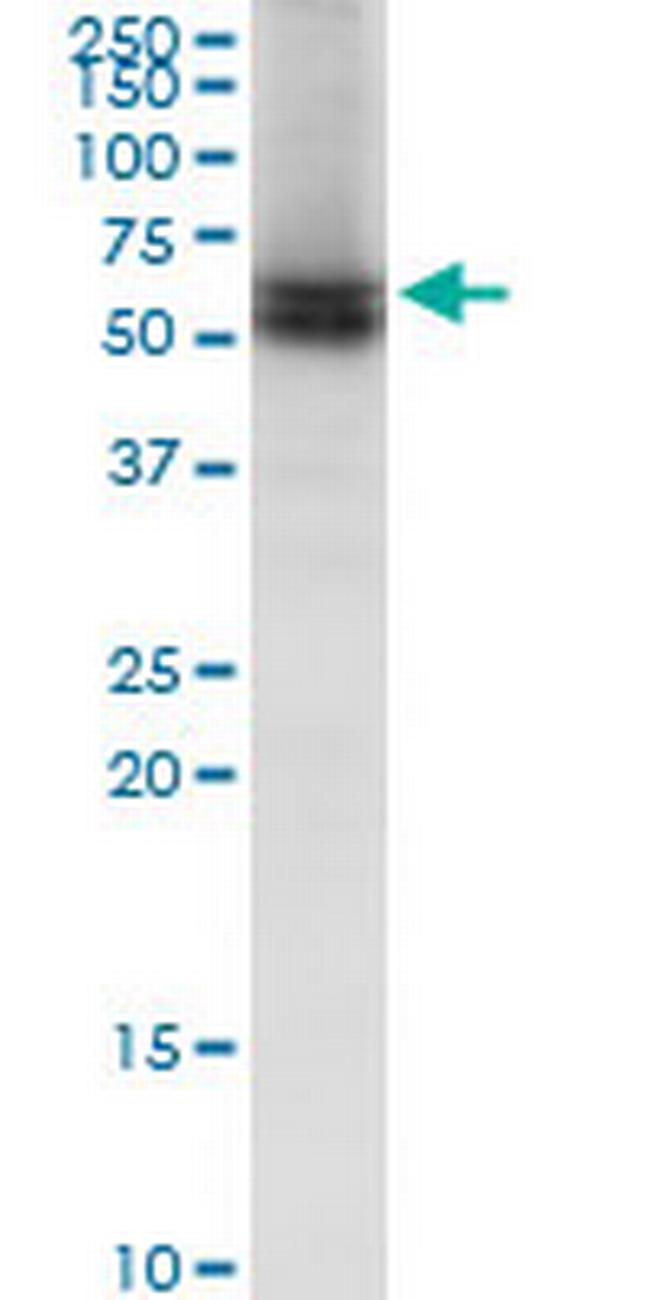 LBR Antibody in Western Blot (WB)