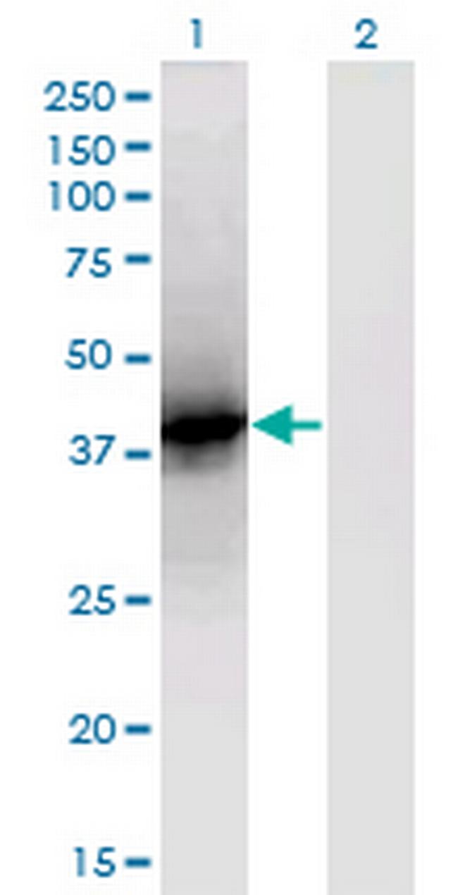 LCAT Antibody in Western Blot (WB)
