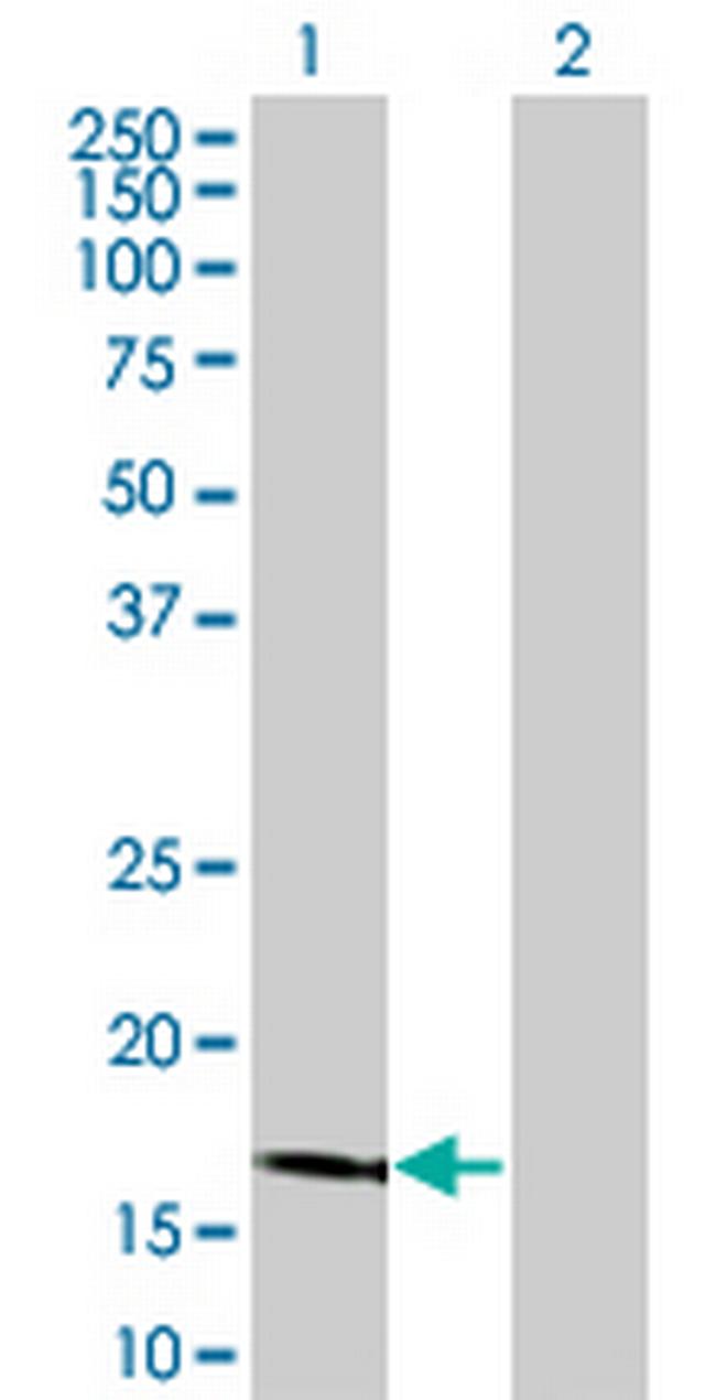 LCN1 Antibody in Western Blot (WB)