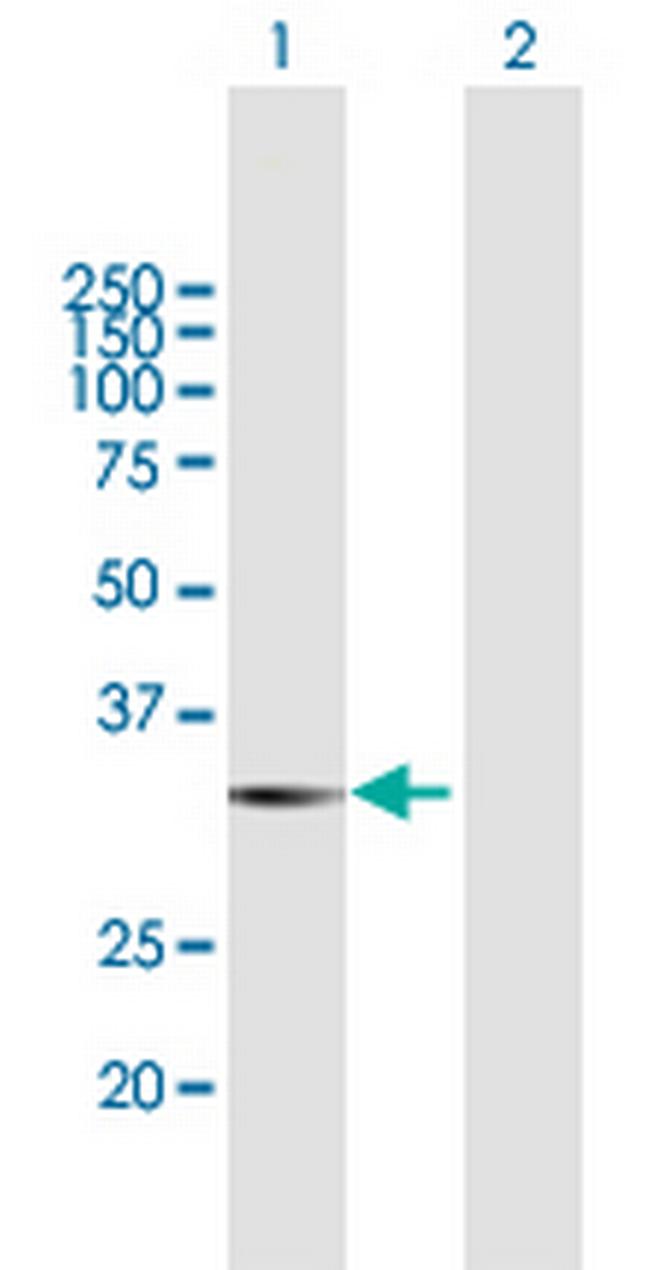 LGALS8 Antibody in Western Blot (WB)