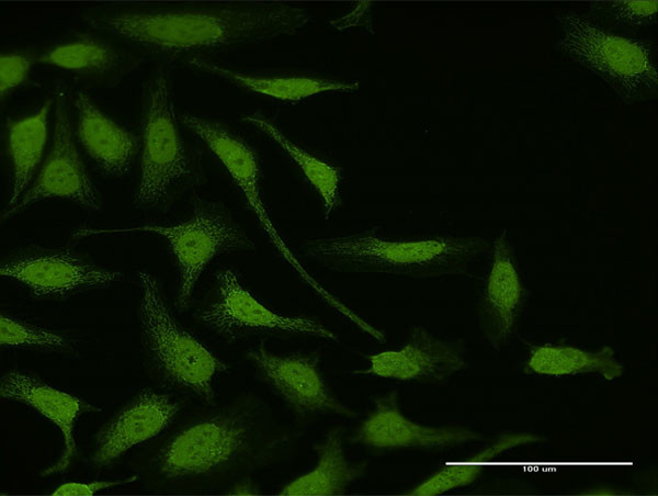 LIMK1 Antibody in Immunocytochemistry (ICC/IF)