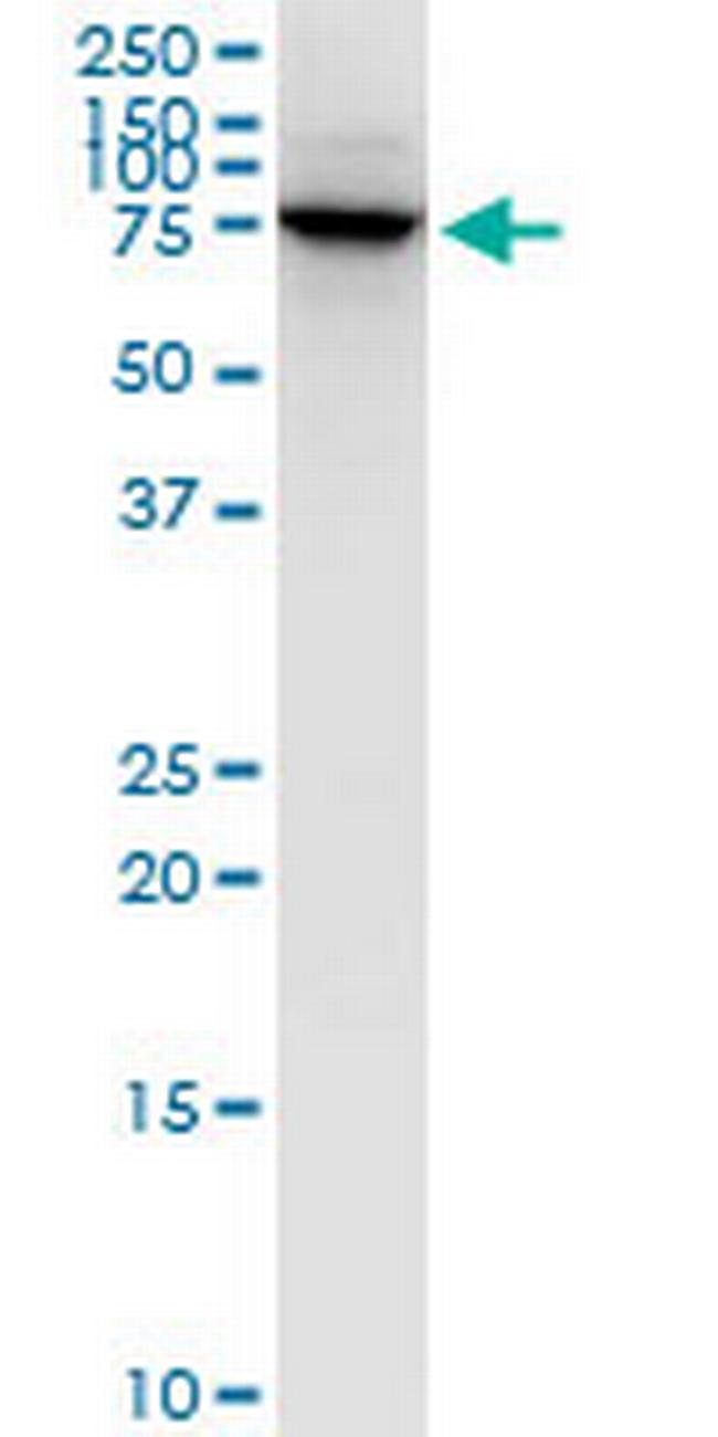 LIMK1 Antibody in Western Blot (WB)