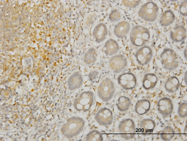 LIMK1 Antibody in Immunohistochemistry (Paraffin) (IHC (P))