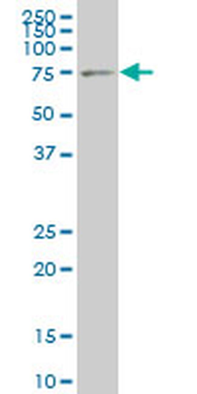 LIMK1 Antibody in Western Blot (WB)