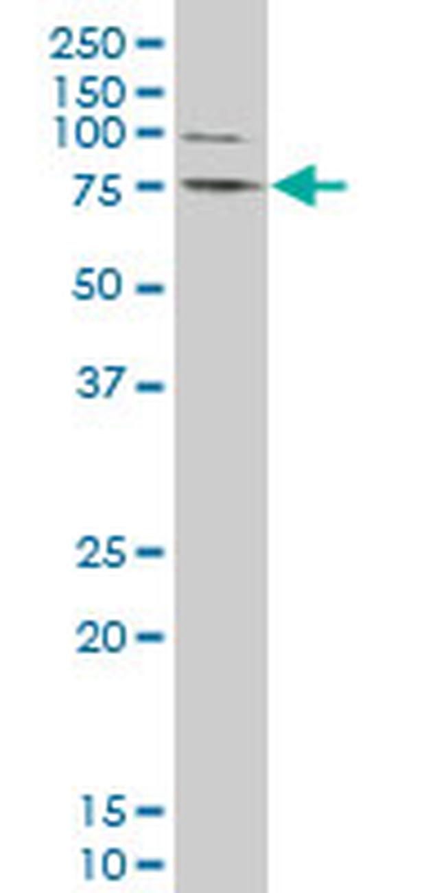LIMK1 Antibody in Western Blot (WB)