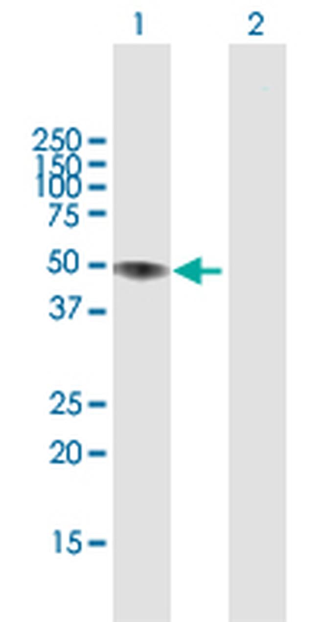LIPA Antibody in Western Blot (WB)