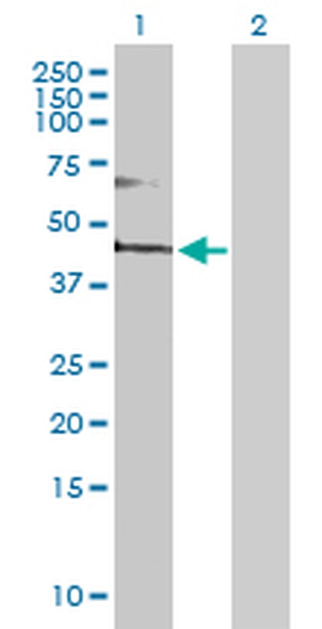 FADS3 Antibody in Western Blot (WB)