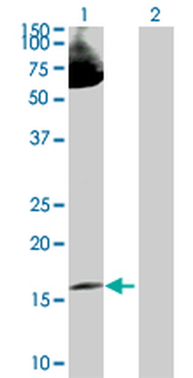 LMO2 Antibody in Western Blot (WB)