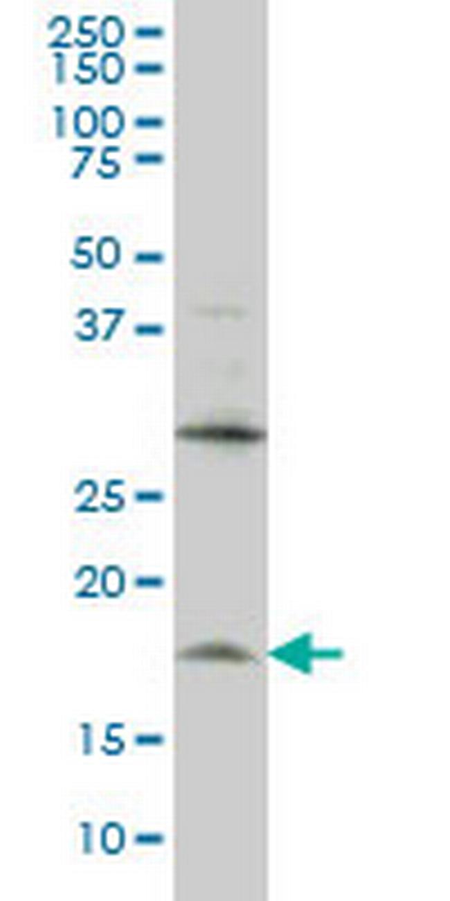 LMO2 Antibody in Western Blot (WB)