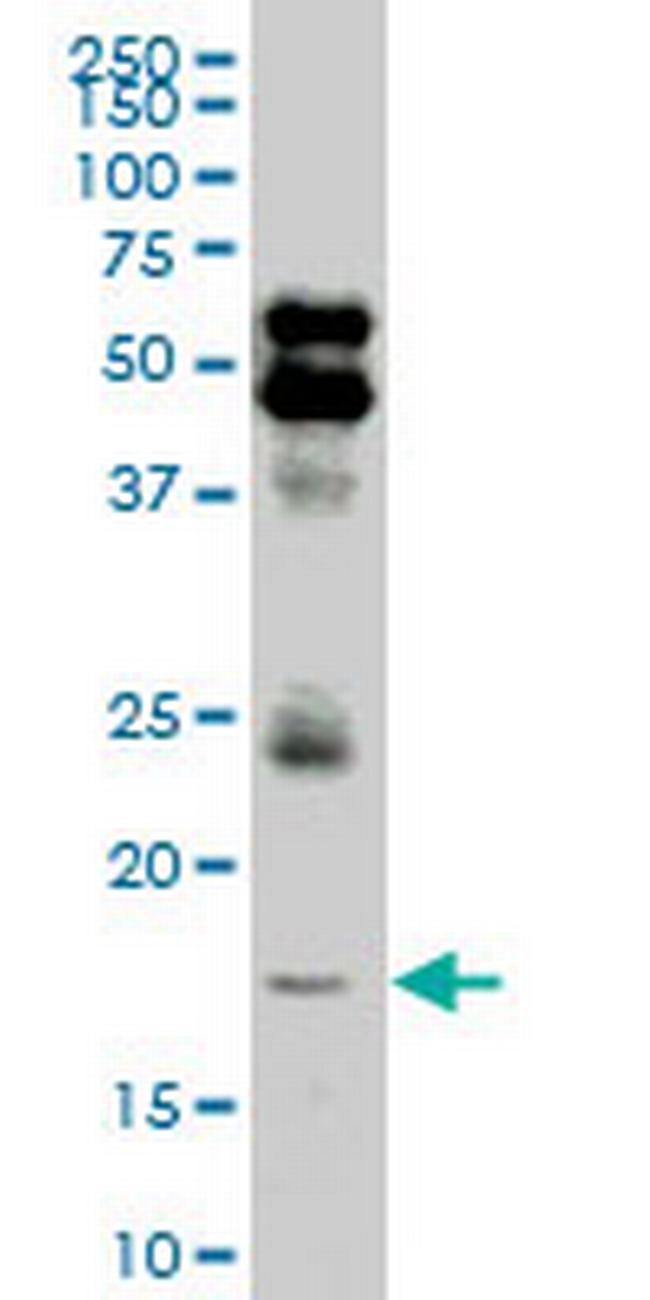 LMO2 Antibody in Western Blot (WB)
