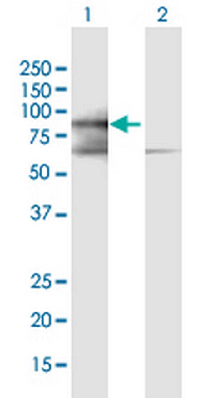 PRICKLE3 Antibody in Western Blot (WB)