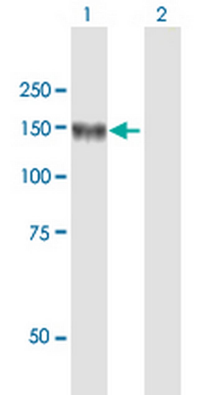 LNPEP Antibody in Western Blot (WB)