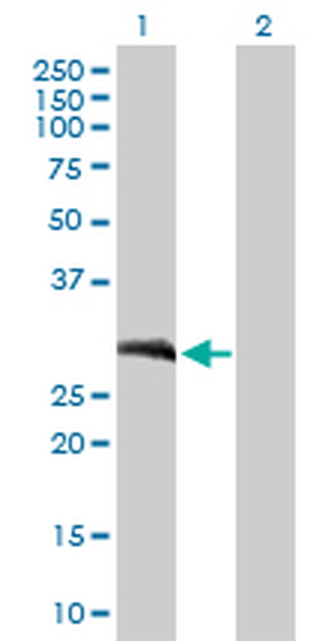 LOR Antibody in Western Blot (WB)