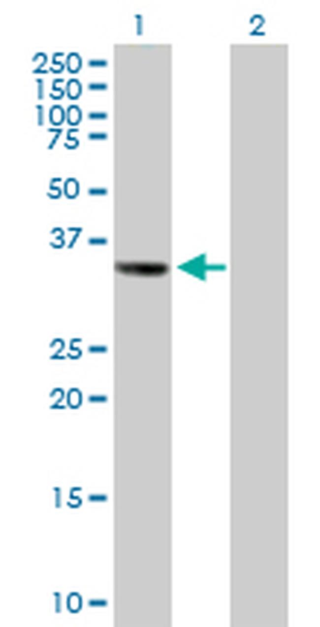 LSAMP Antibody in Western Blot (WB)