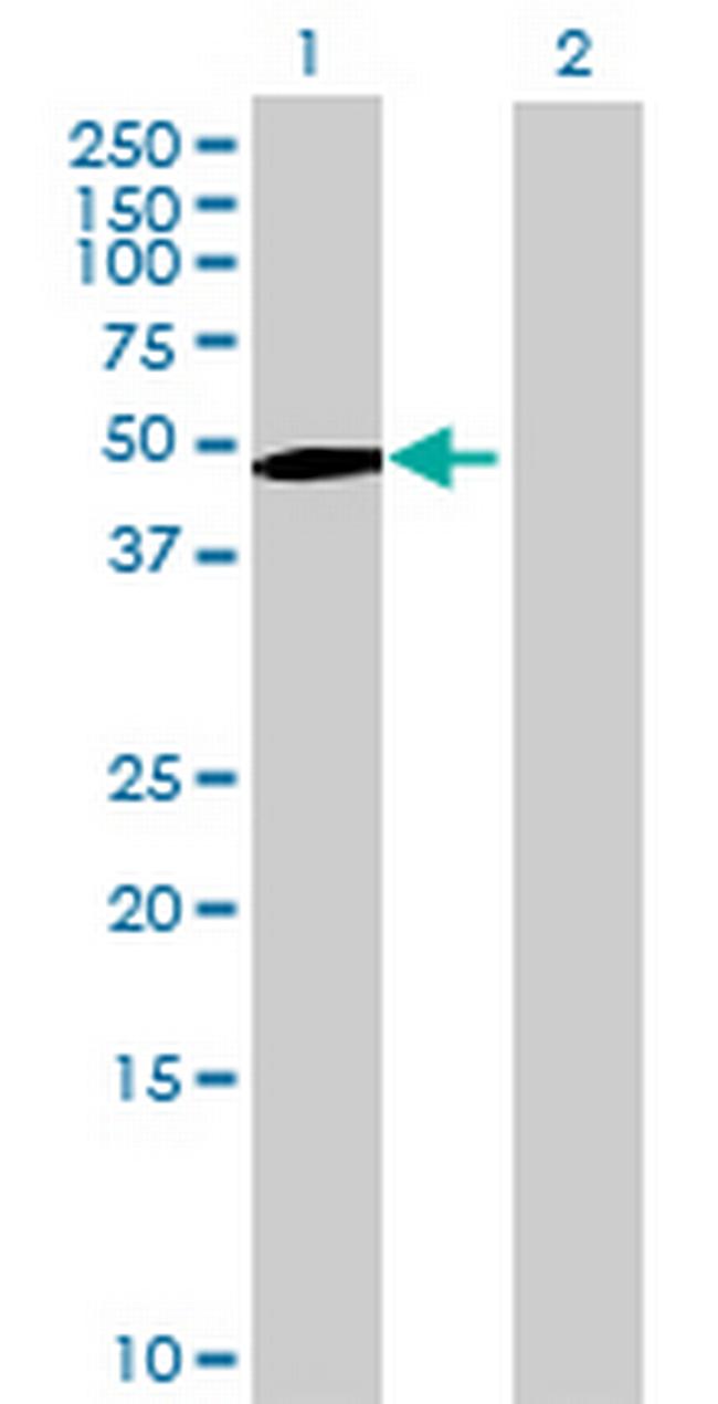 LSP1 Antibody in Western Blot (WB)