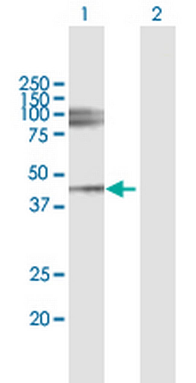 LUM Antibody in Western Blot (WB)