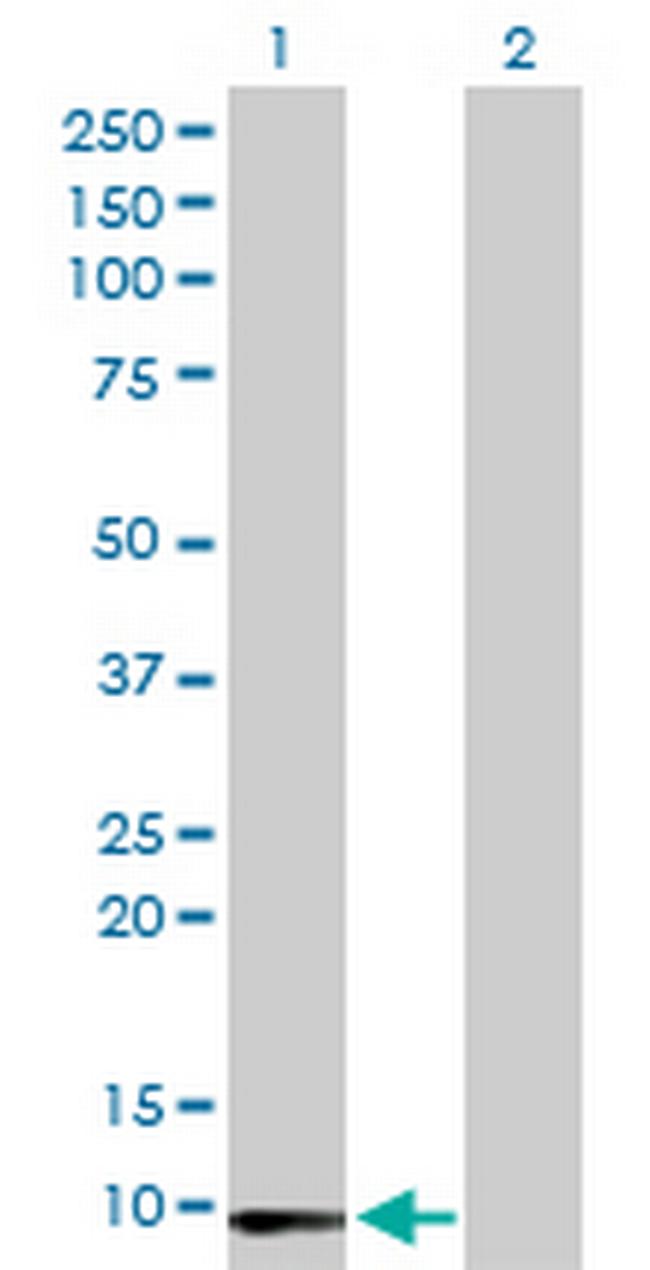 LY6E Antibody in Western Blot (WB)