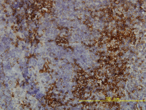LY6H Antibody in Immunohistochemistry (Paraffin) (IHC (P))