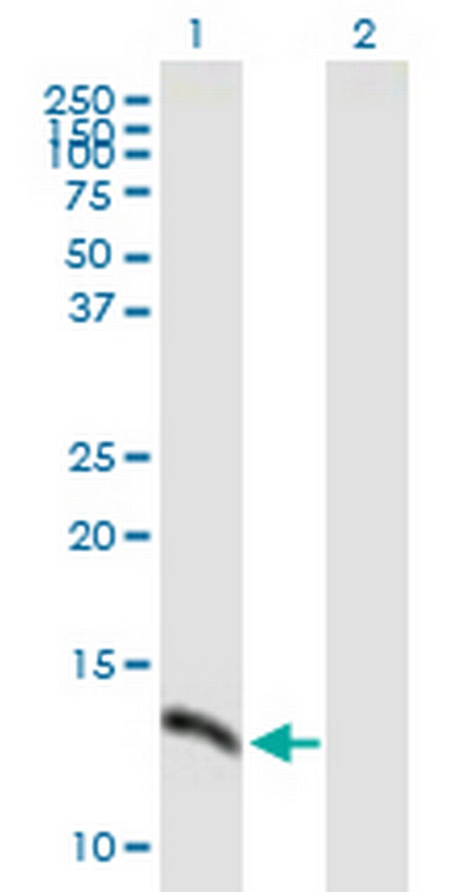 SH2D1A Antibody in Western Blot (WB)