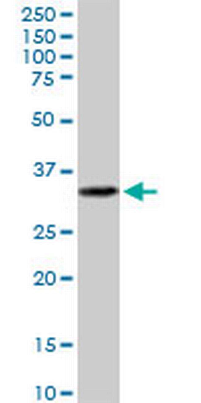 EPCAM Antibody in Western Blot (WB)