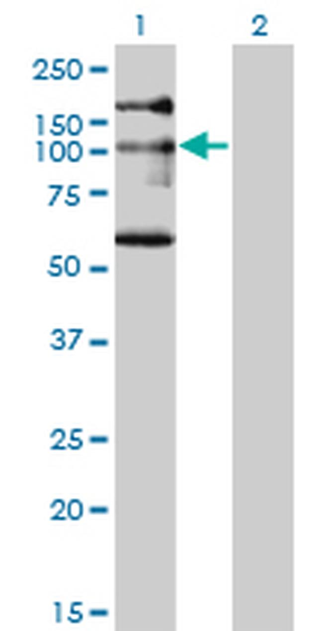 NBR1 Antibody in Western Blot (WB)