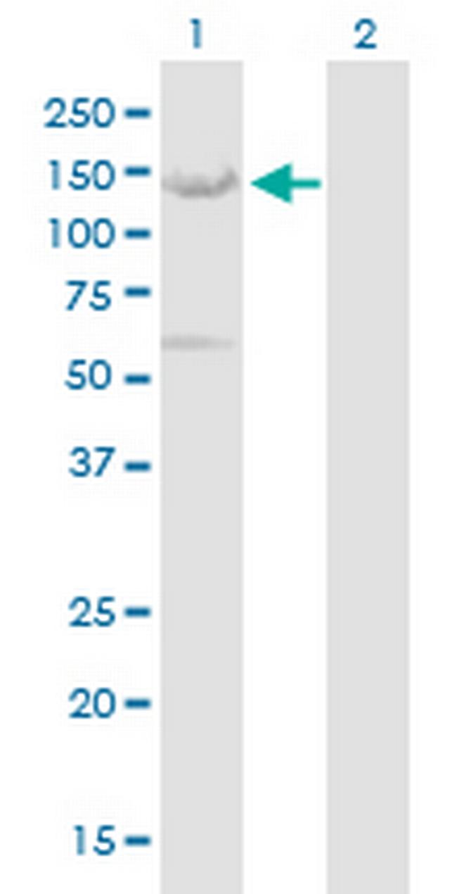 NBR1 Antibody in Western Blot (WB)