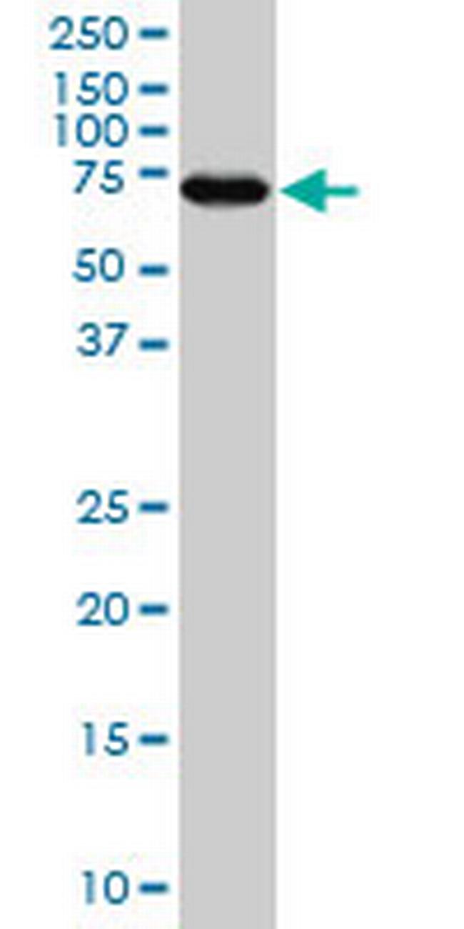 MARCKS Antibody in Western Blot (WB)