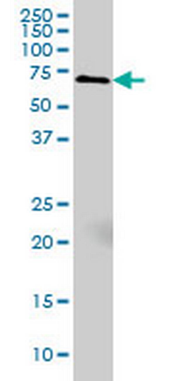 MARCKS Antibody in Western Blot (WB)