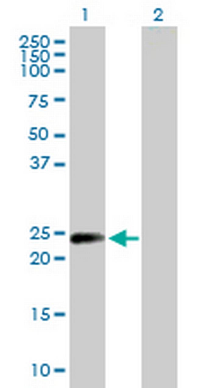 MAD2L1 Antibody in Western Blot (WB)