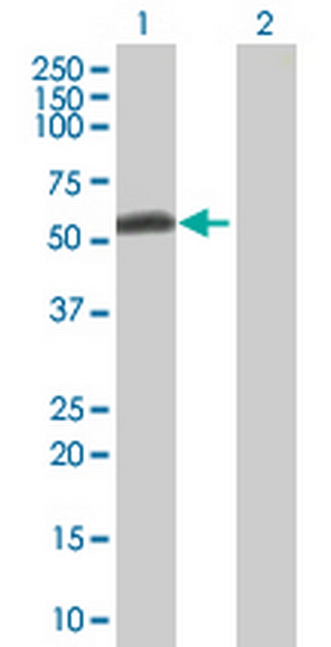 SMAD5 Antibody in Western Blot (WB)