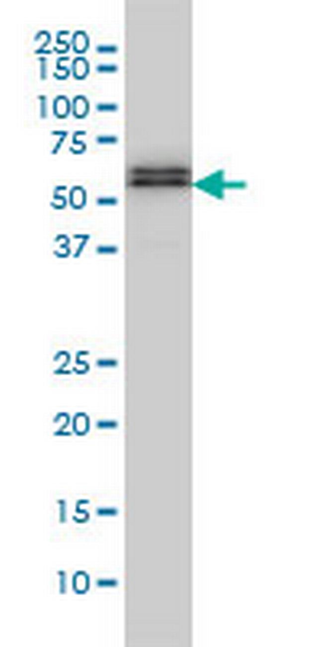SMAD5 Antibody in Western Blot (WB)
