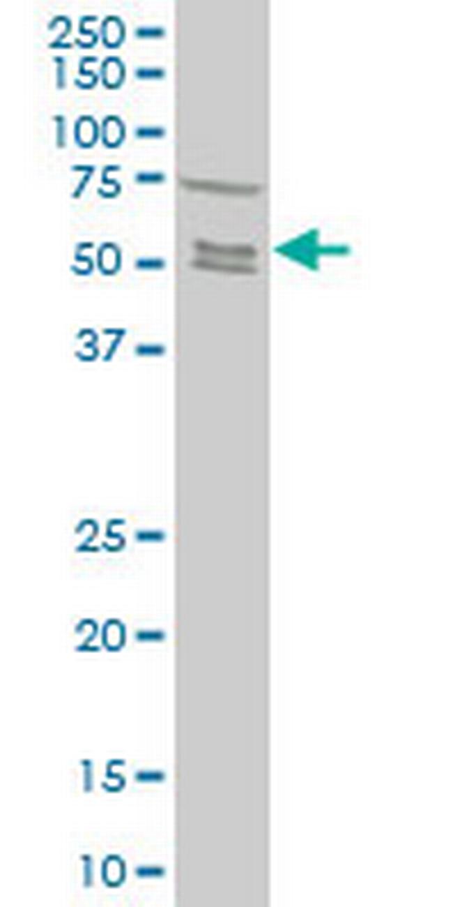 SMAD5 Antibody in Western Blot (WB)